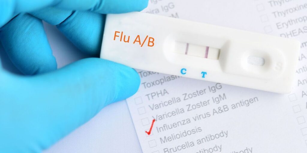 Rapid Influenza Diagnostic Tests (RIDTs)